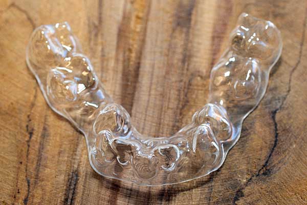 Invisalign pris Tyskland - Usynlig bøjle til tandregning